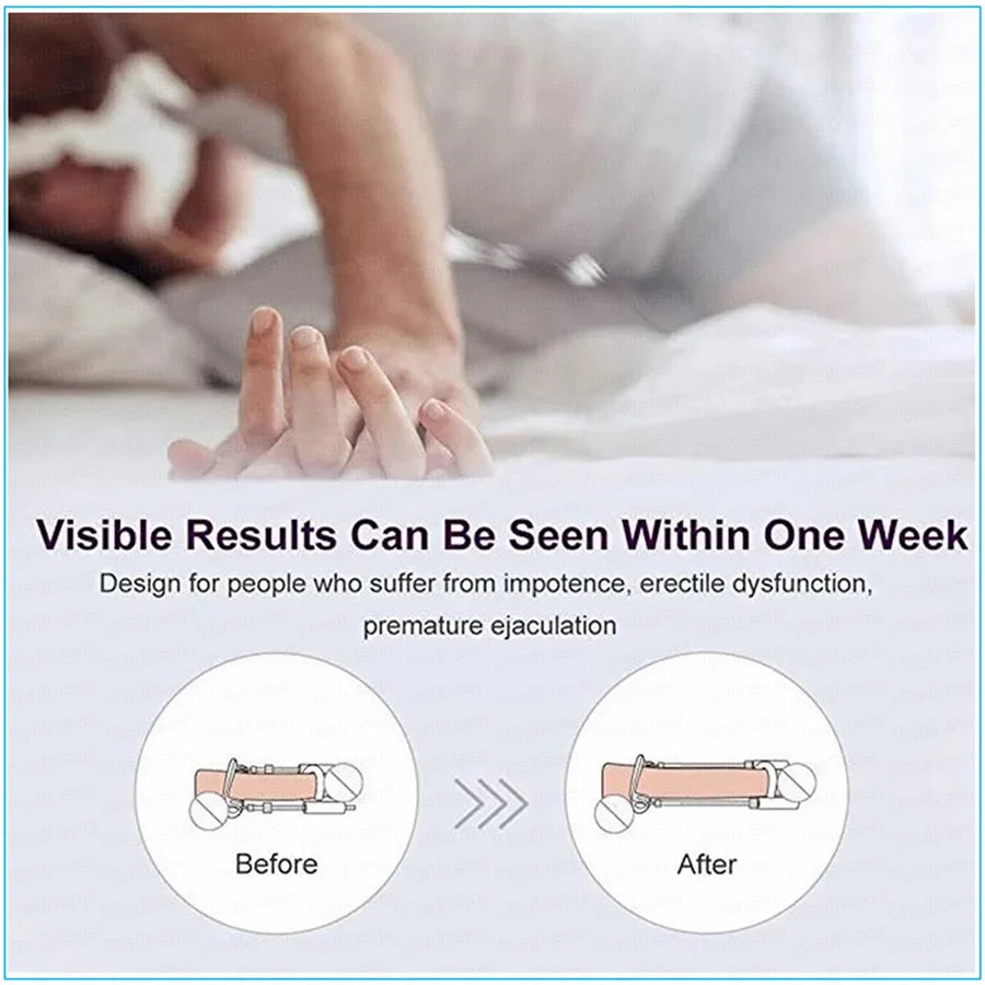 Sex Toys Tools 3rd Penis Extender Enlargement Edge Stretcher Pump Sex Toys For Male Penis Exercise Strap Dick Enlargers